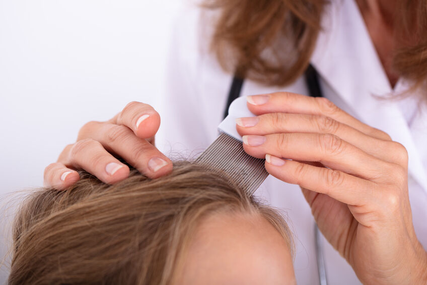 Everything you need to know about head lice Parys Gazette