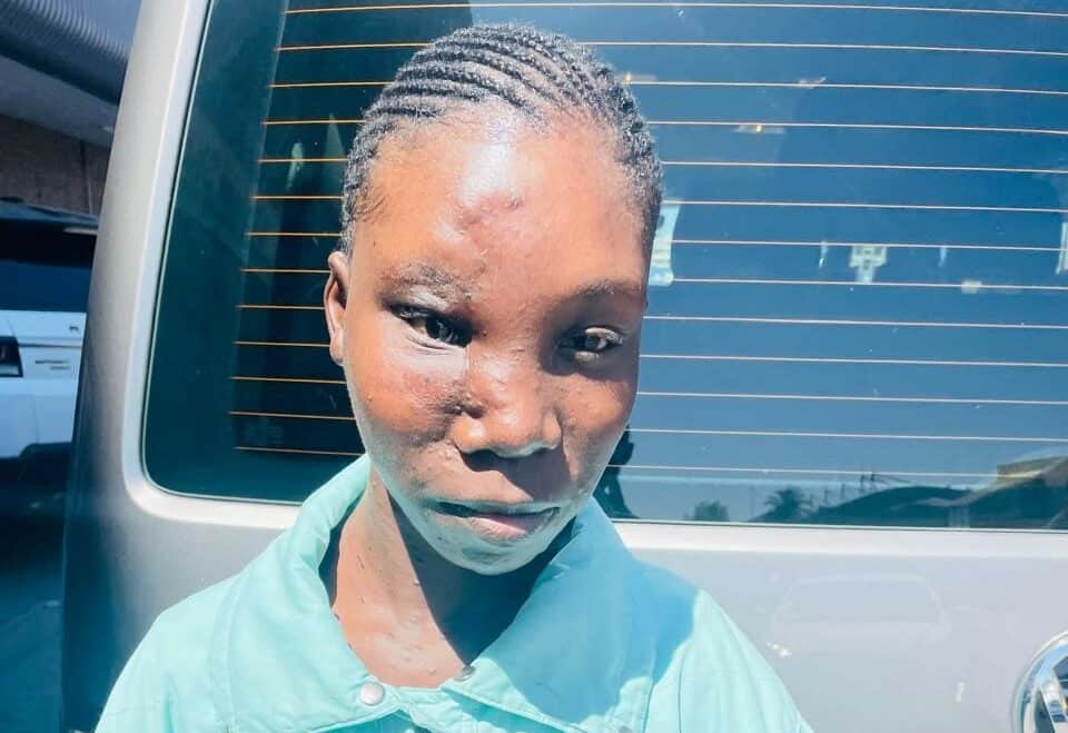 Dimpho Given Dimpho's life-changing surgery for a smile | Review