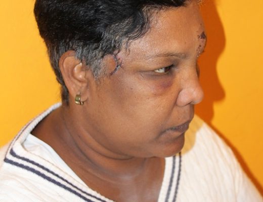 Roselyn Bouverie claims she was assaulted by one of her neighbours.